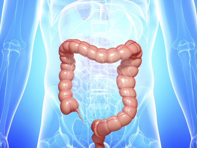 Рак на дебелото черво, симптоми, диагностика, скриних и лечение